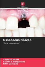 Osseodensificação af Yashasri Nayak