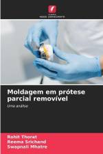Moldagem em prótese parcial removível af Rohit Thorat