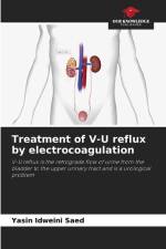 Treatment of V-U reflux by electrocoagulation af Yasin Idweini Saed