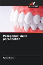 Patogenesi della parodontite af Faraz Patel
