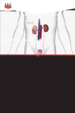 Traitement du reflux V-U par électrocoagulation af Yasin Idweini Saed