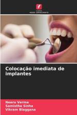 Colocação imediata de implantes af Neeru Verma