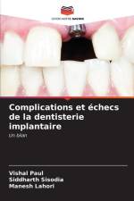 Complications et échecs de la dentisterie implantaire af Vishal Paul