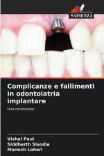 Complicanze e fallimenti in odontoiatria implantare af Vishal Paul
