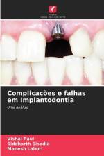 Complicações e falhas em Implantodontia af Vishal Paul