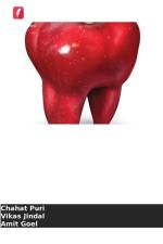 Nutrição e saúde oral: do ponto de vista periodontal af Chahat Puri