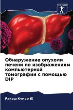Obnaruzhenie opuholi pecheni po izobrazheniqm komp'üternoj tomografii s pomosch'ü DIP af Rakesh Kumar Ju