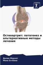 Osteoartrit: patogenez i al'ternatiwnye metody lecheniq af Dalia Medhat