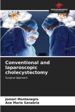 Conventional and laparoscopic cholecystectomy af Jomari Montenegro