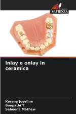 Inlay e onlay in ceramica af Kerena Joseline