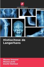 Histiocitose de Langerhans af Mouna Snoussi
