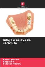 Inlays e onlays de cerâmica af Kerena Joseline