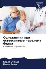Oslozhneniq pri osteosinteze pereloma bedra af Karla Obando