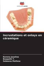 Incrustations et onlays en céramique af Kerena Joseline