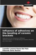 Influence of adhesives on the bonding of ceramic brackets af Leandro Lorenzi Rasia Dal Polo