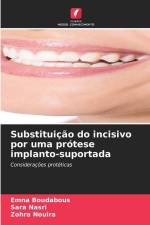 Substituição do incisivo por uma prótese implanto-suportada af Emna Boudabous