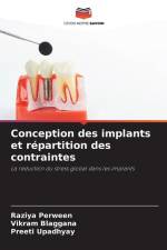 Conception des implants et répartition des contraintes af Raziya Perween