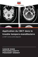 Application du CBCT dans le trouble temporo-mandibulaire af Saquib Khan