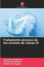 Tratamento precoce da má oclusão de classe III af Vaisakh Vasudevan