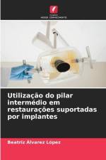 Utilização do pilar intermédio em restaurações suportadas por implantes af Beatriz Álvarez López