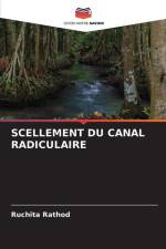 SCELLEMENT DU CANAL RADICULAIRE af Ruchita Rathod