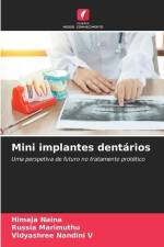 Mini implantes dentários af Himaja Naina