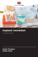 Implant immédiat af Zalak Thakkar