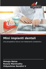 Mini impianti dentali af Himaja Naina