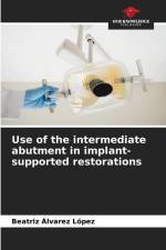 Use of the intermediate abutment in implant-supported restorations af Beatriz Álvarez López