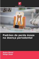Padrões de perda óssea na doença periodontal af Asma Desai