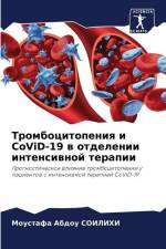 Trombocitopeniq i CoViD-19 w otdelenii intensiwnoj terapii af Moustafa Abdou Soilihi