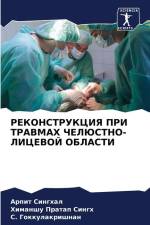 REKONSTRUKCIYa PRI TRAVMAH ChELJuSTNO-LICEVOJ OBLASTI af Arpit Singhal