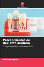 Procedimentos de implante dentário af Edunuri Rajitha