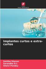 Implantes curtos e extra-curtos af Smitha Sharan