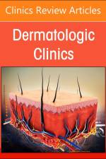 Psoriasis: Contemporary and Future Therapies, an Issue of Dermatologic Clinics af Jeffrey M Cohen