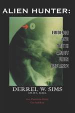 Alien Implants af Derrel W Sims