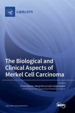 The Biological and Clinical Aspects of Merkel Cell Carcinoma