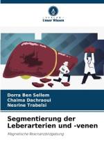 Segmentierung der Leberarterien und -venen af Dorra Ben Sellem