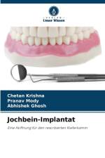 Jochbein-Implantat af Chetan Krishna