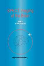SPECT Imaging of the Brain af R. Duncan