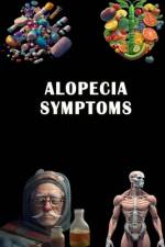 Alopecia Symptoms af Jacub Somsuzen