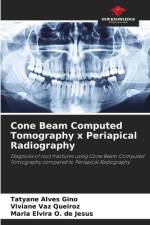 Cone Beam Computed Tomography x Periapical Radiography af Tatyane Alves Gino