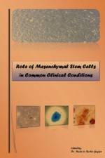 Role of Mesenchymal Stem Cells in Common Clinical Conditions af Mudasir Bashir
