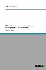 Ethical problems concerning organ transplantation in 