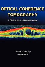 Optical Coherence Tomography a Clinical Atlas of Retinal Images af Darrin A. Landry