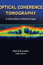 Optical Coherence Tomography af A. Landry Darrin