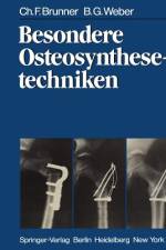 Besondere Osteosynthesetechniken af B. G. Weber