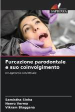 Furcazione parodontale e suo coinvolgimento af Samistha Sinha