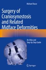 Surgery of Craniosynostosis and Related Midface Deformities af Michael Rasse