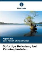 Sofortige Belastung bei Zahnimplantaten af Arpit Sikri